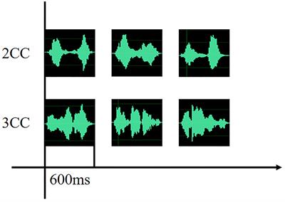 Auditory event-related potentials based on name stimuli: A pilot study